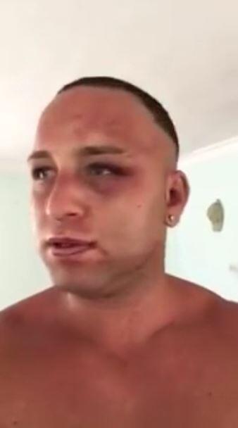 Survivor yarışmacısı Taner Tolga Tarlacıyı 15 kişi dövdü