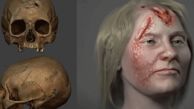 500 yıl önce ölen kadın yeniden canlandırıldı! Cinsel hastalık kafatasını yedi