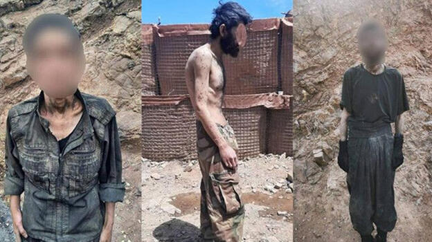 PKK'lı terörist teslim oldu! Görüntüsü ortaya çıktı: Açlıktan bağırsakları delindi
