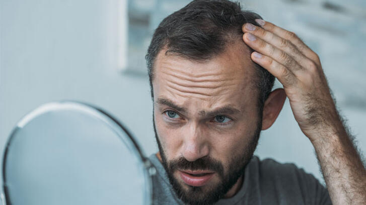 Erkeklerde saç dökülmesi nedenleri ve belirtileri nelerdir?