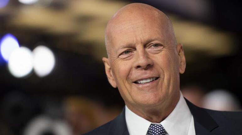 Bruce Willis’in hastalığı afazi nedir, neden olur Afazi hastalığının belirtileri nelerdir, tedavisi var mı