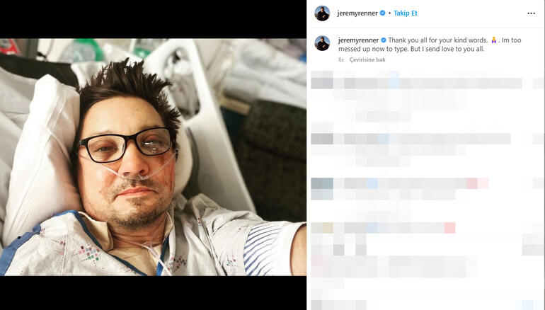 Ünlü aktör Jeremy Renner kaza geçirdi Hastaneden paylaştı