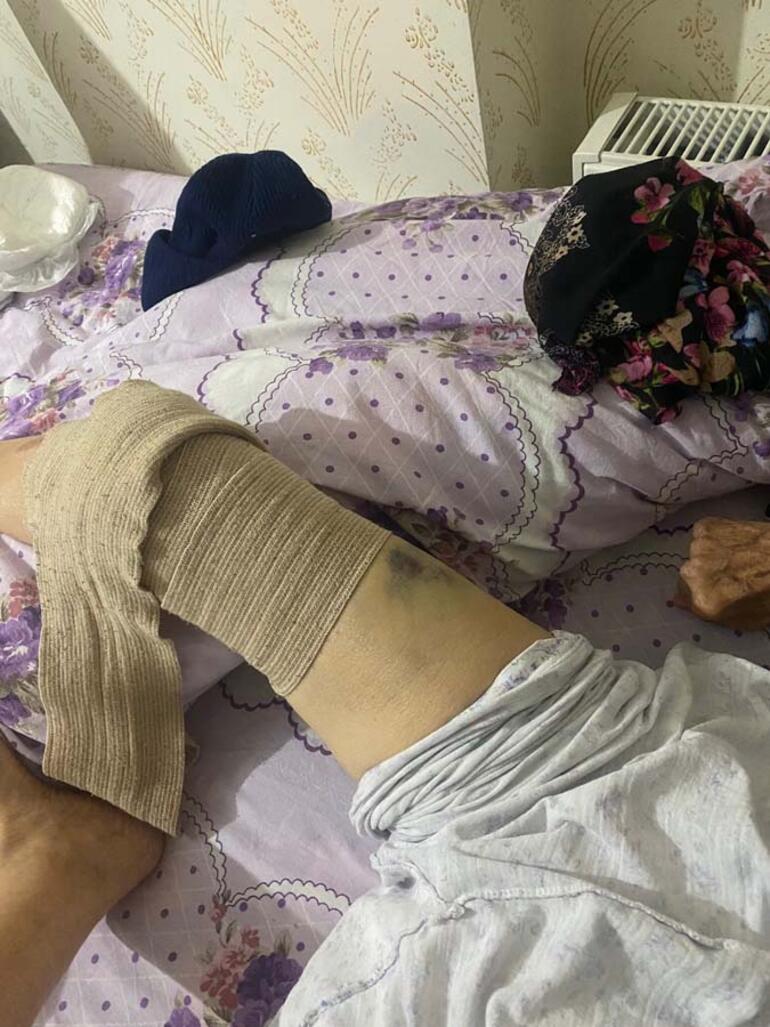 91 yaşındaki kadına bakıcı dehşeti Yaşlı kadın hastanede ölüm kalım savaşı veriyor
